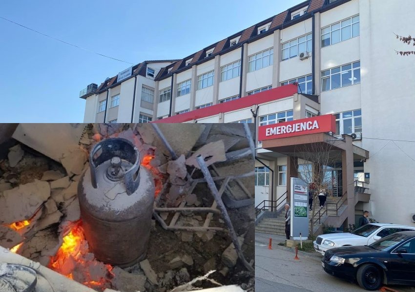 shperthimi-i-bomboles-ne-kciq-te-mitrovices,-nje-paciente-dergohet-per-sherim-ne-suedi,-kosova-s’ka-qender-per-djegie