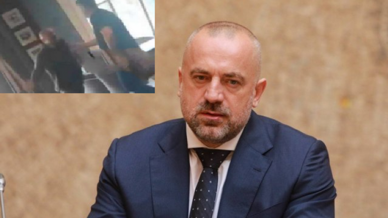 radoiciq-perdor-dhune-brutale-ndaj-nje-serbi-nga-veriu-i-kosoves