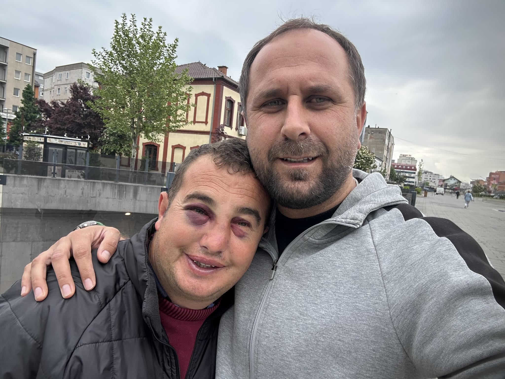 cufa-u-rr*ah-brutalisht-ne-qender-te-ferizajt,-flet-kujdestari-i-tij:-qe-qysh-ndodhi-ngjarja