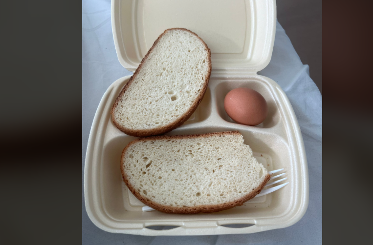 “Ushqim skandaloz për pacientët në QKUK” – Infermieri Duraku reagon me foto dhe akuza për keqmenaxhim