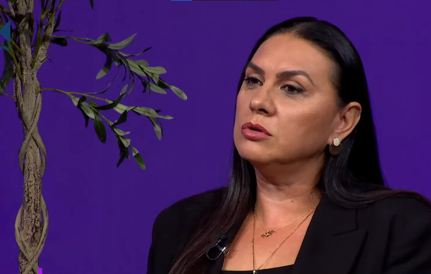 E mbijetuara e kancerit të gjirit, Merita Pacolli: Rënia e flokëve ishte moment i rëndë për djalin tim