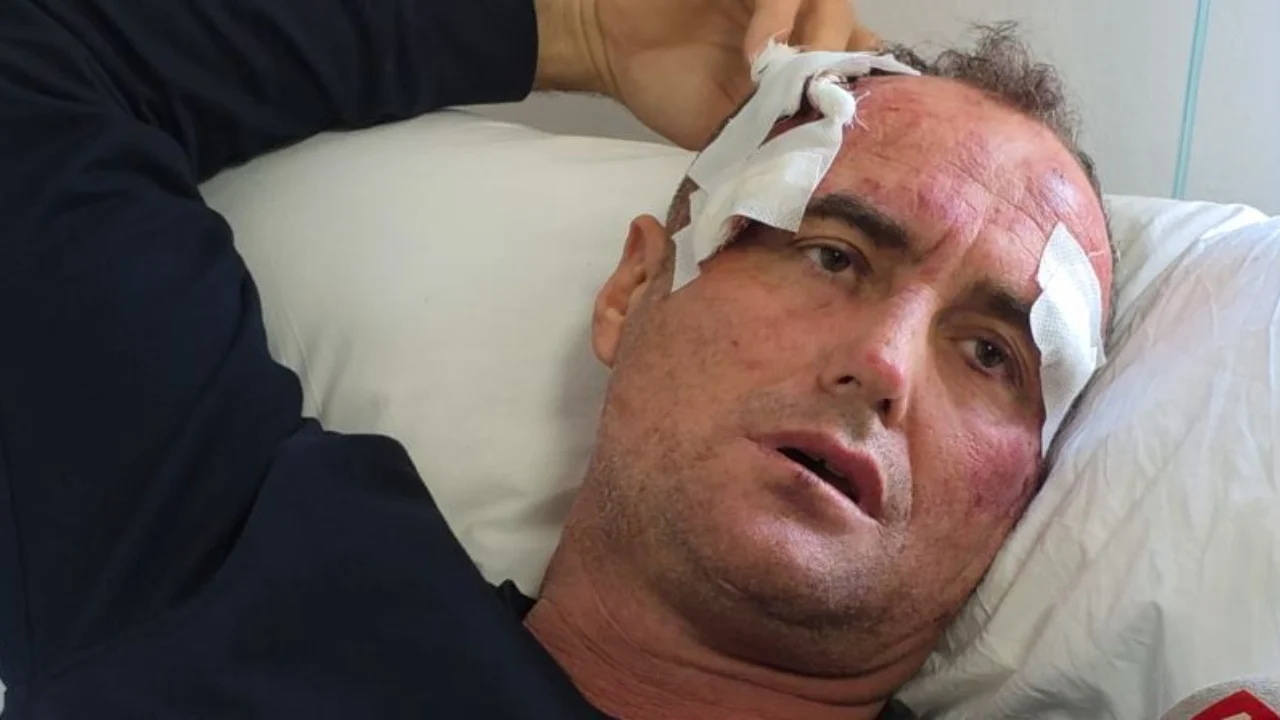 “I bëra motrës së tij një koment në Facebook”, punonjësi i policisë dhunon rëndë babë e bir