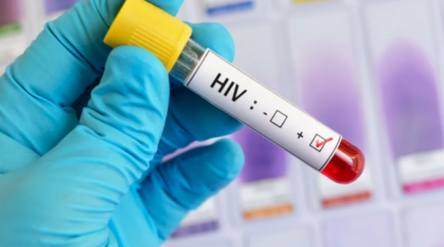 dhjete-raste-te-reja-me-hiv-ne-muajt-e-fundit,-dy-viktima-–-rritet-testimi-vullnetar